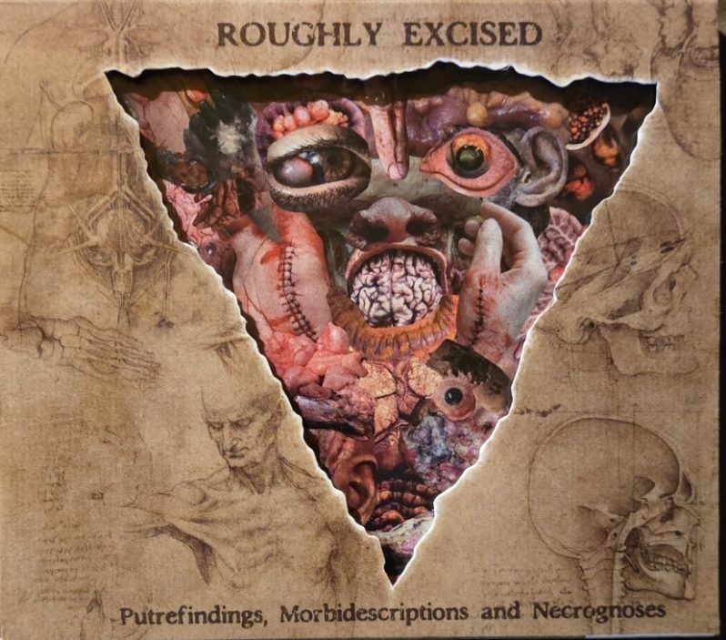 Lymphatic Phlegm – Roughly Excised(CD/2021)PUTREFACTION SETS IN PATHOLOGIST ROT